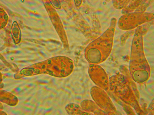 Preparation stained Preparation stained
