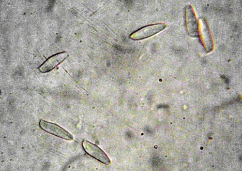 Tylopilus felleus Tylopilus felleus