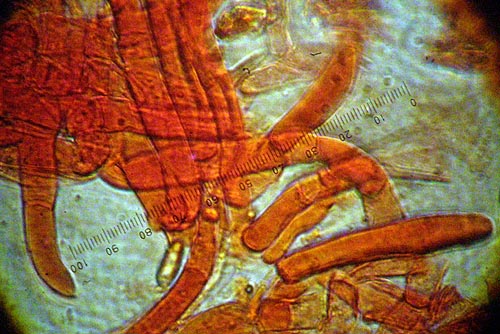Xerocomus persicolor pileipelis