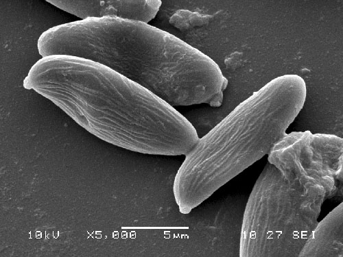 Xerocomus pruinatus Xerocomus pruinatus